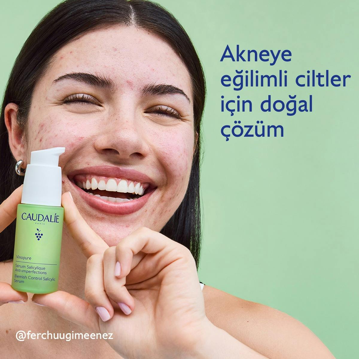 Akne Karşıtı Salisilik Serum