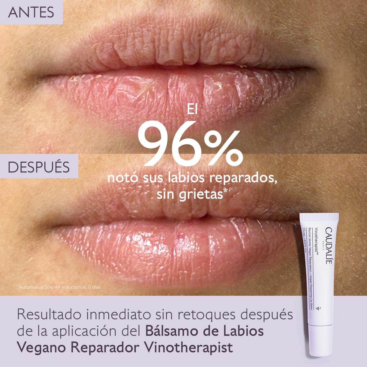 Pedido roacutan en línea