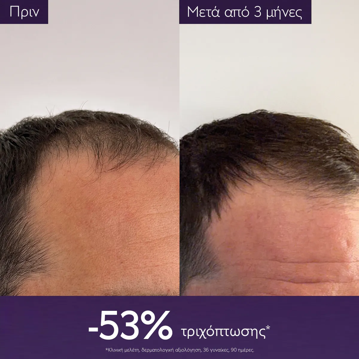 Anti-Hair Loss Serum