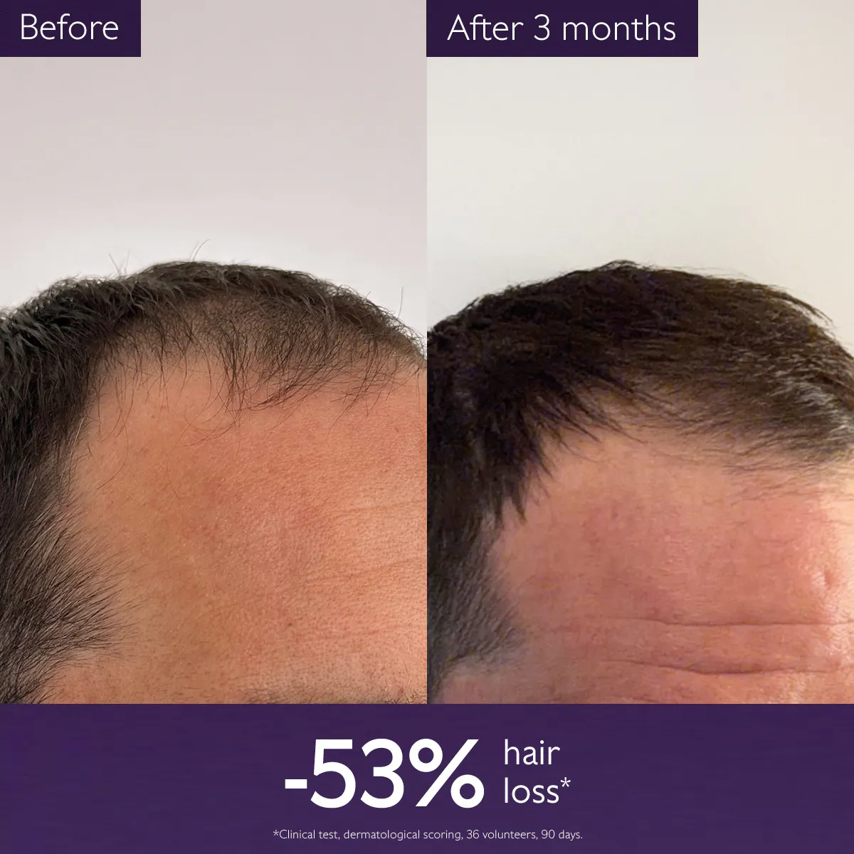Anti-Hair Loss Serum