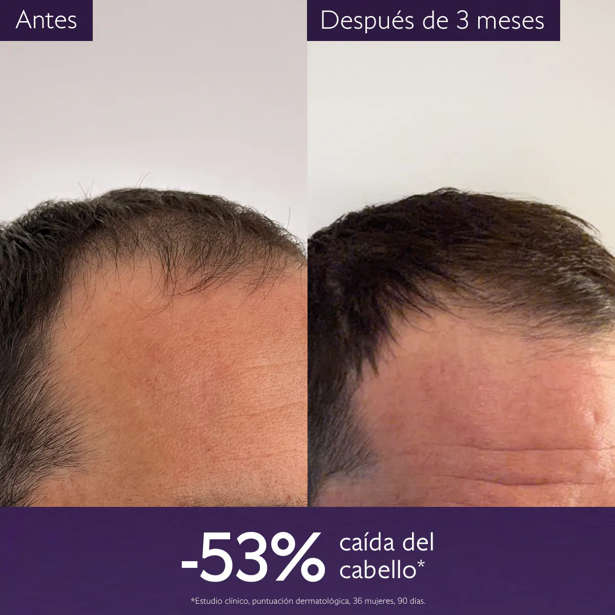 Sérum Capilar Anticaída