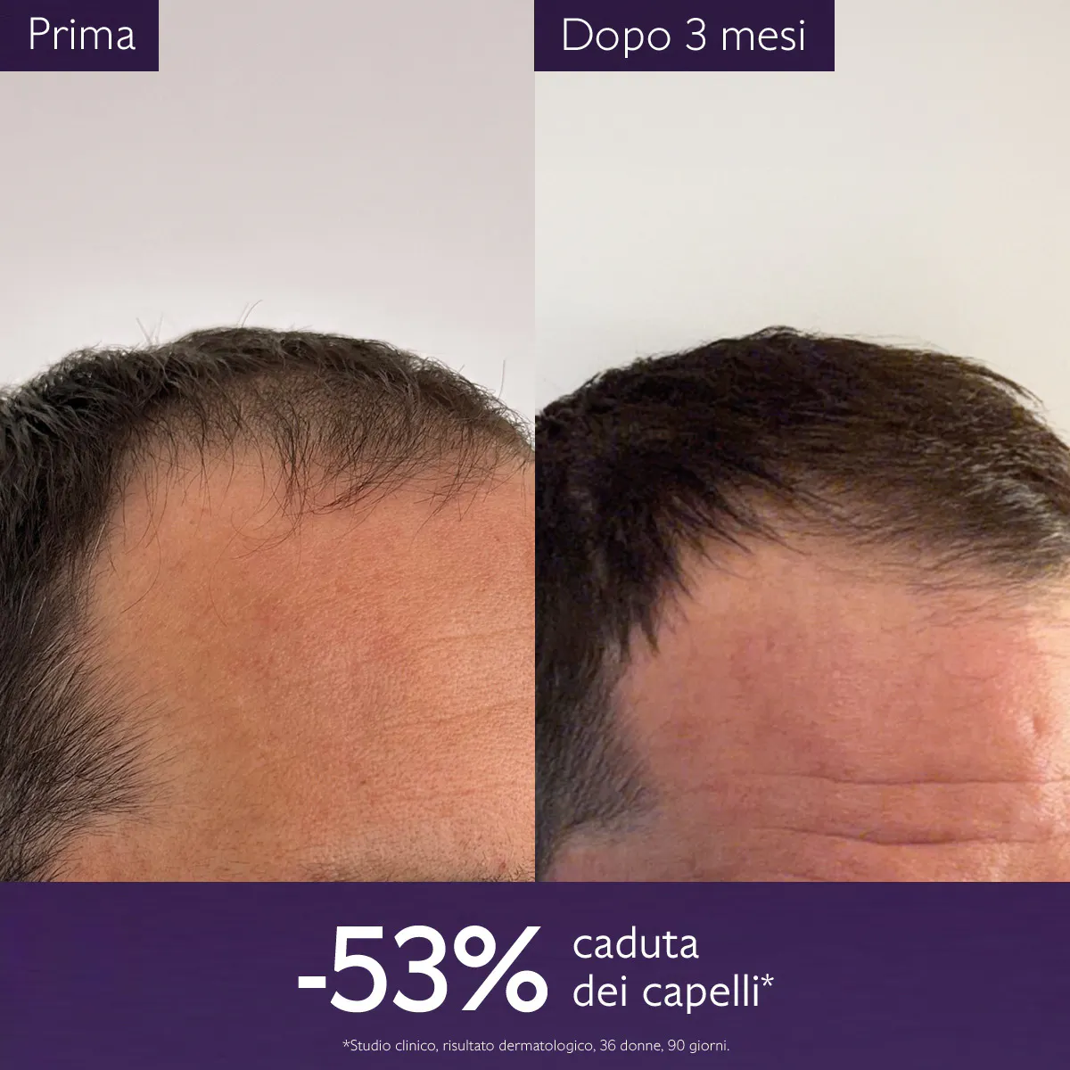 Siero Capelli Anticaduta