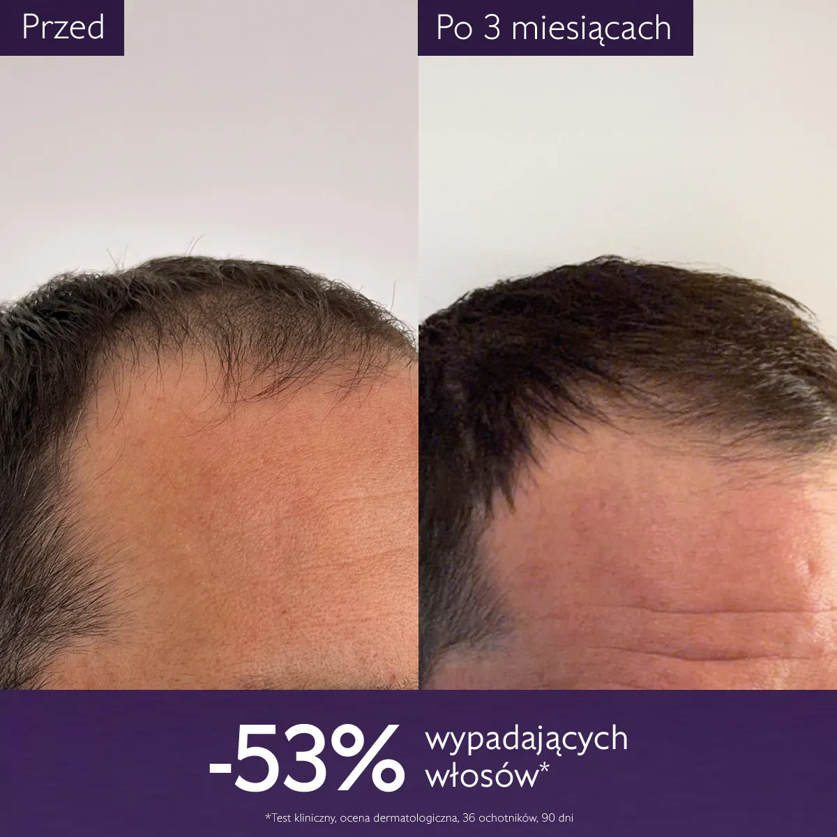Serum przeciw wypadaniu włosów