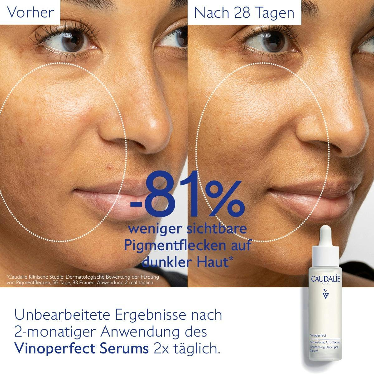 Serum für mehr Ausstrahlung und gegen Pigmentflecken mit Viniferine, Alternative zu Vitamin C