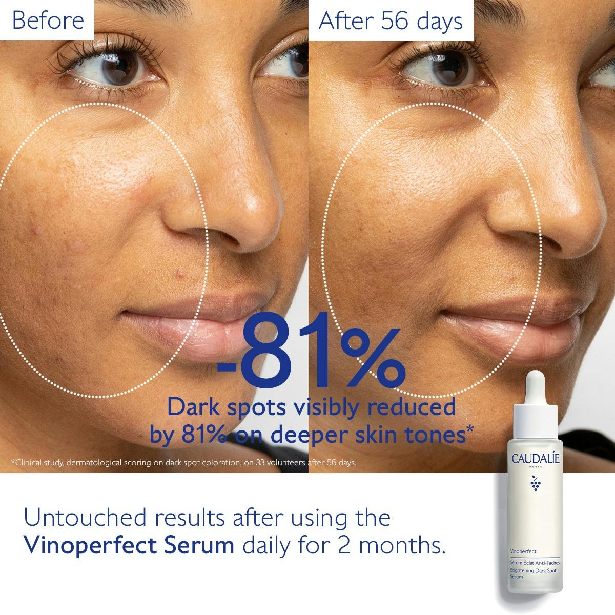 Dark Spot Brightening Serum Vitamin C Alternative