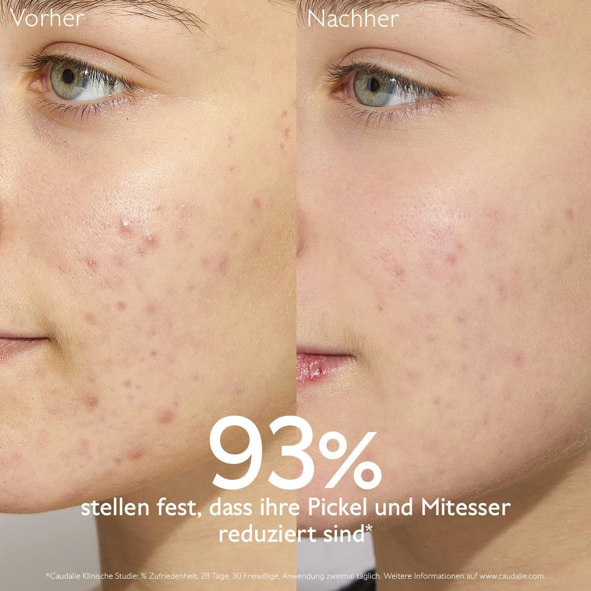 Mattierendes Feuchtigkeit spendendes Fluid mit Siliziumpulver