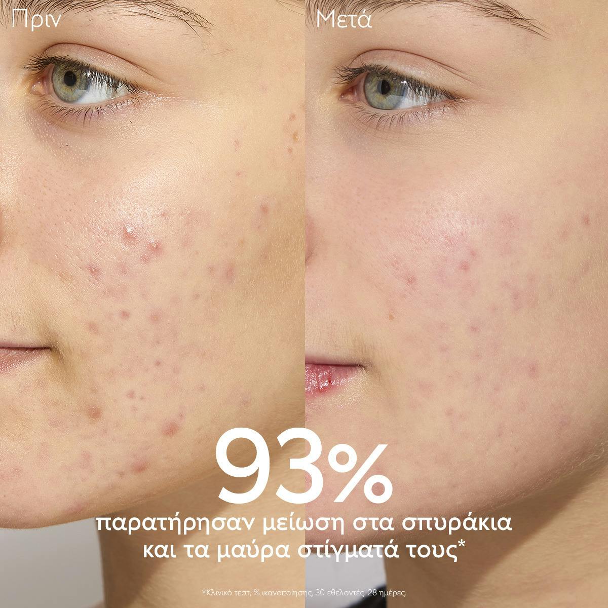 Moisturizing Mattifying Fluid