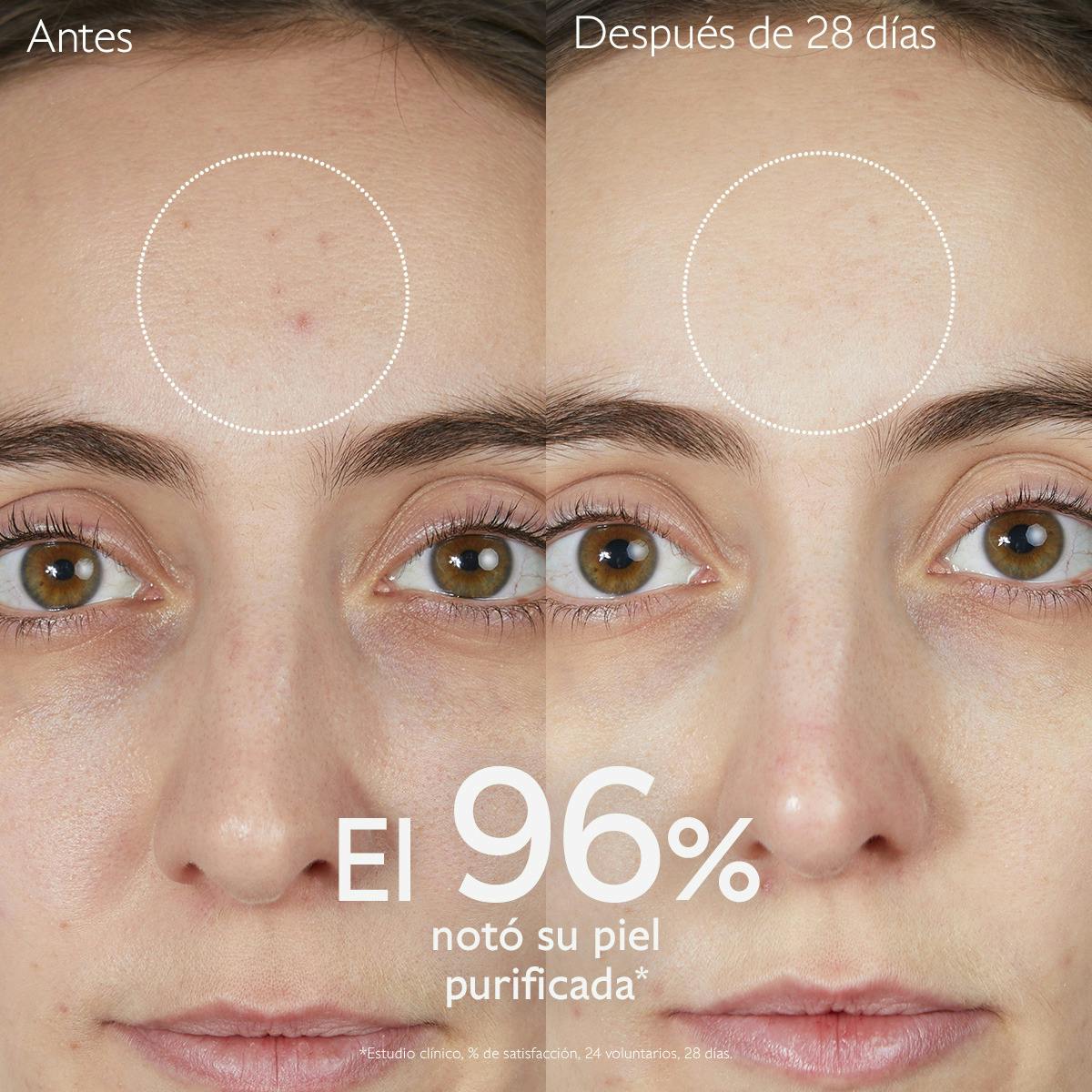 Gelatina Limpiadora Purificante con Acido Salicílico