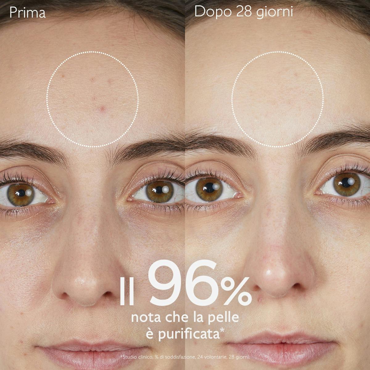 Gel Detergente Purificante all'Acido Salicilico