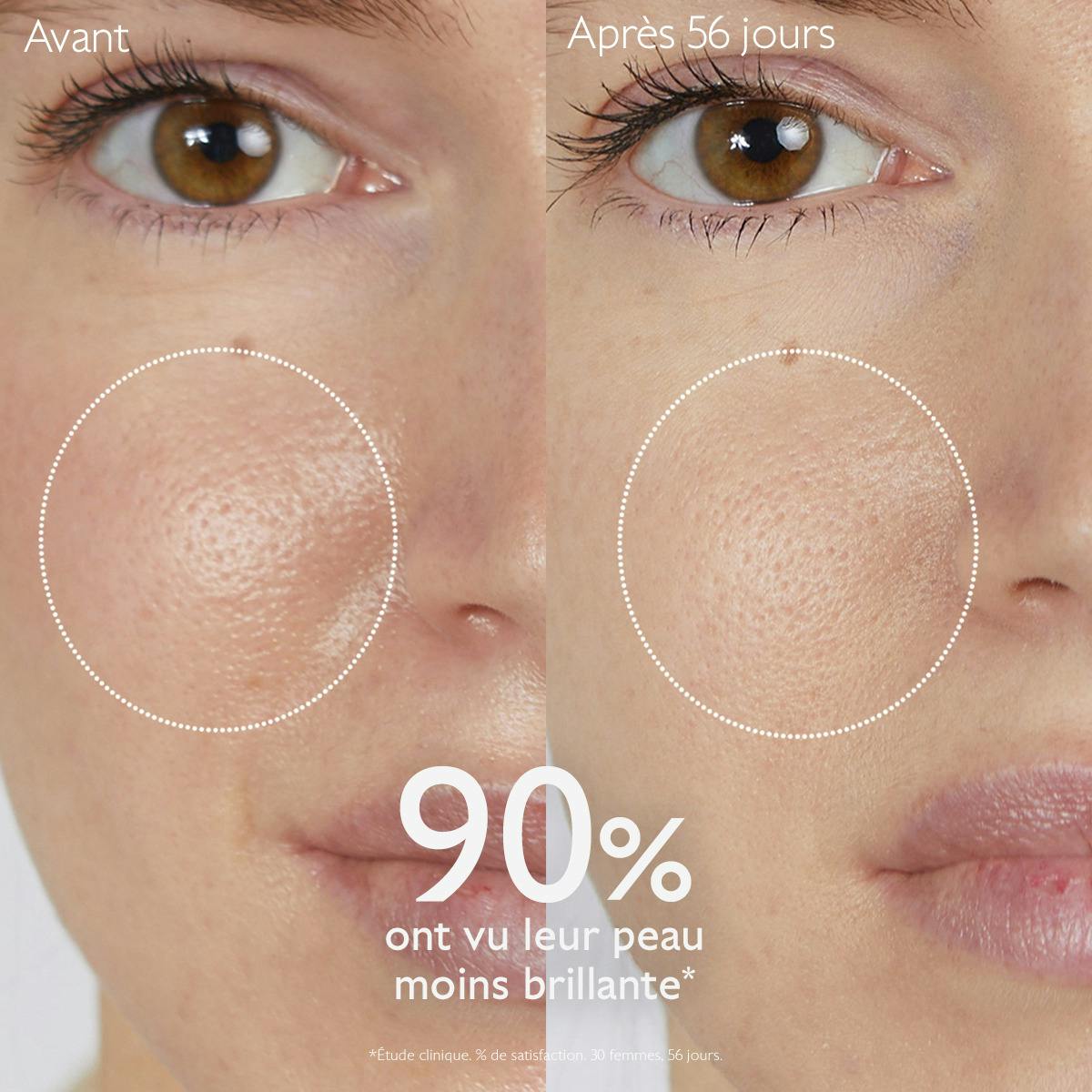 Lotion Purifiante à l'Acide Salicylique