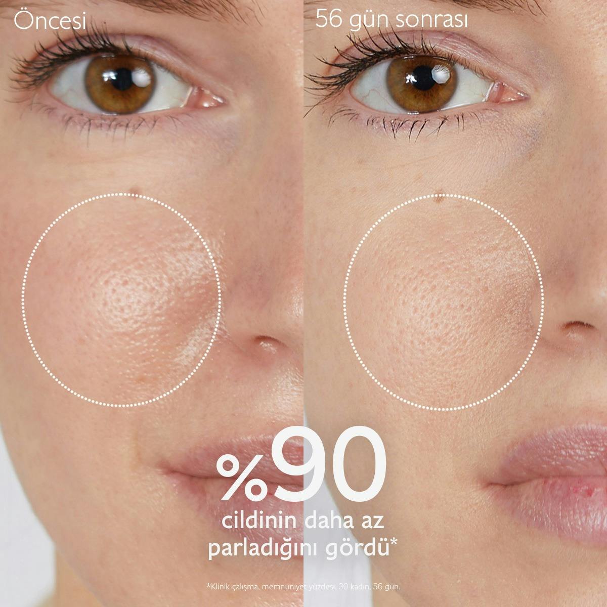 Akne Karşıtı Arındırıcı Tonik