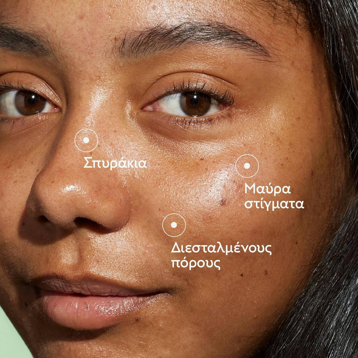 Blemish Control Salicylic Serum