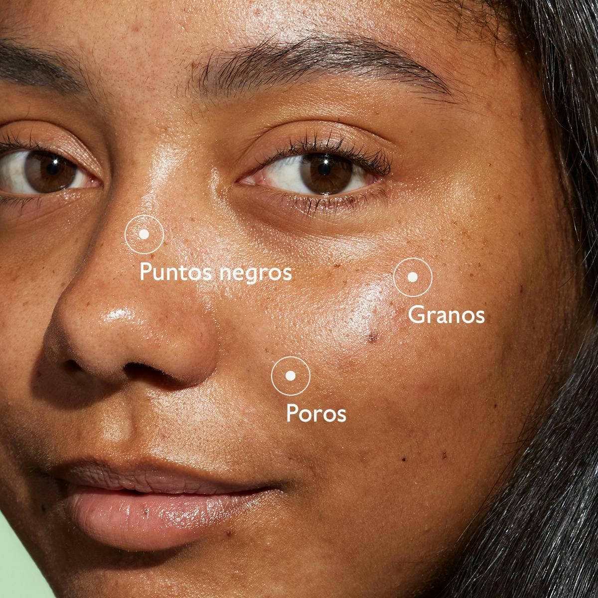 Sérum con Acido Salicílico Anti-imperfecciones