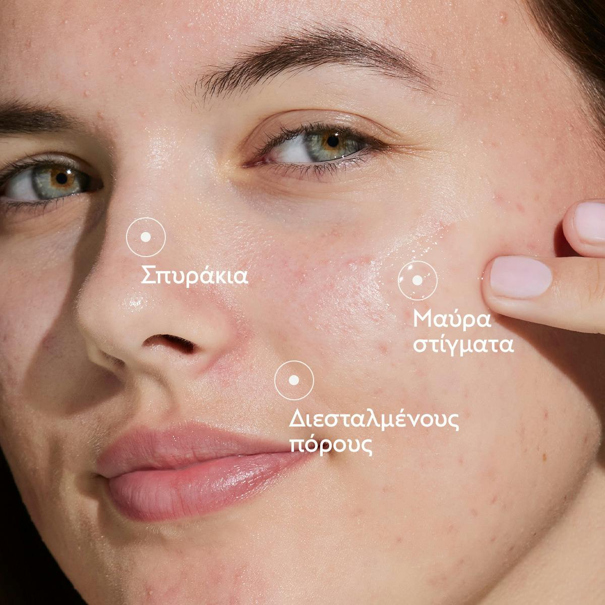 Blemish Control Salicylic Serum