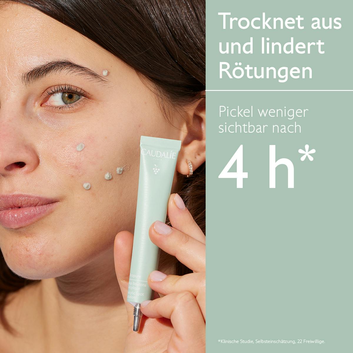 Pickel-Stopp mit Salicylsäure - Frühere Kollektion