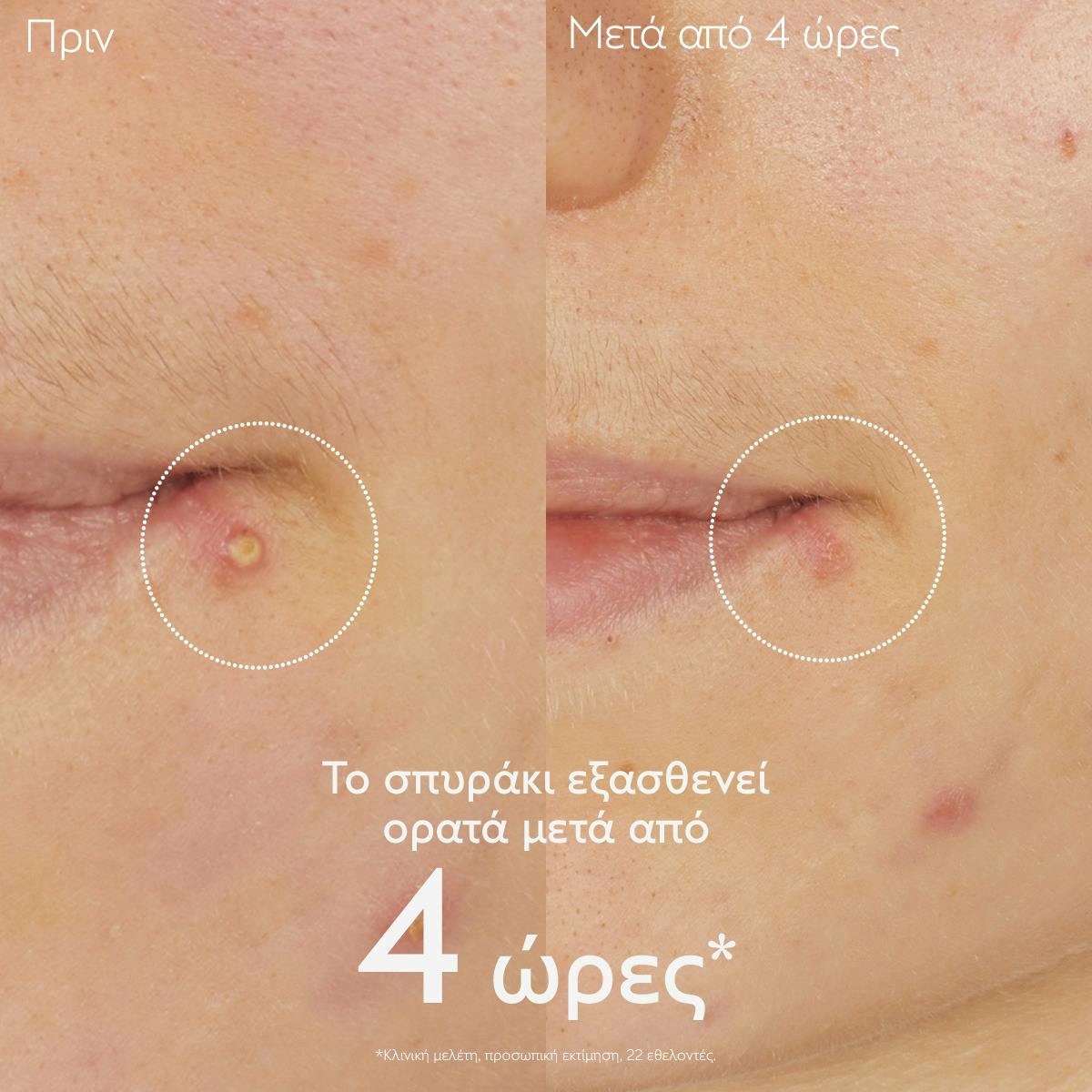 Salicylic Spot Solution