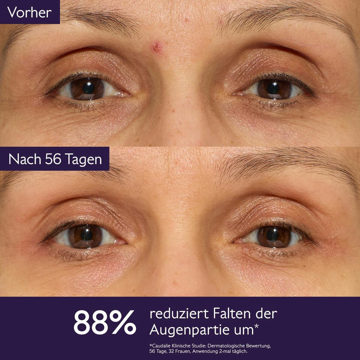 Die Globale Anti-Aging-Lösung
