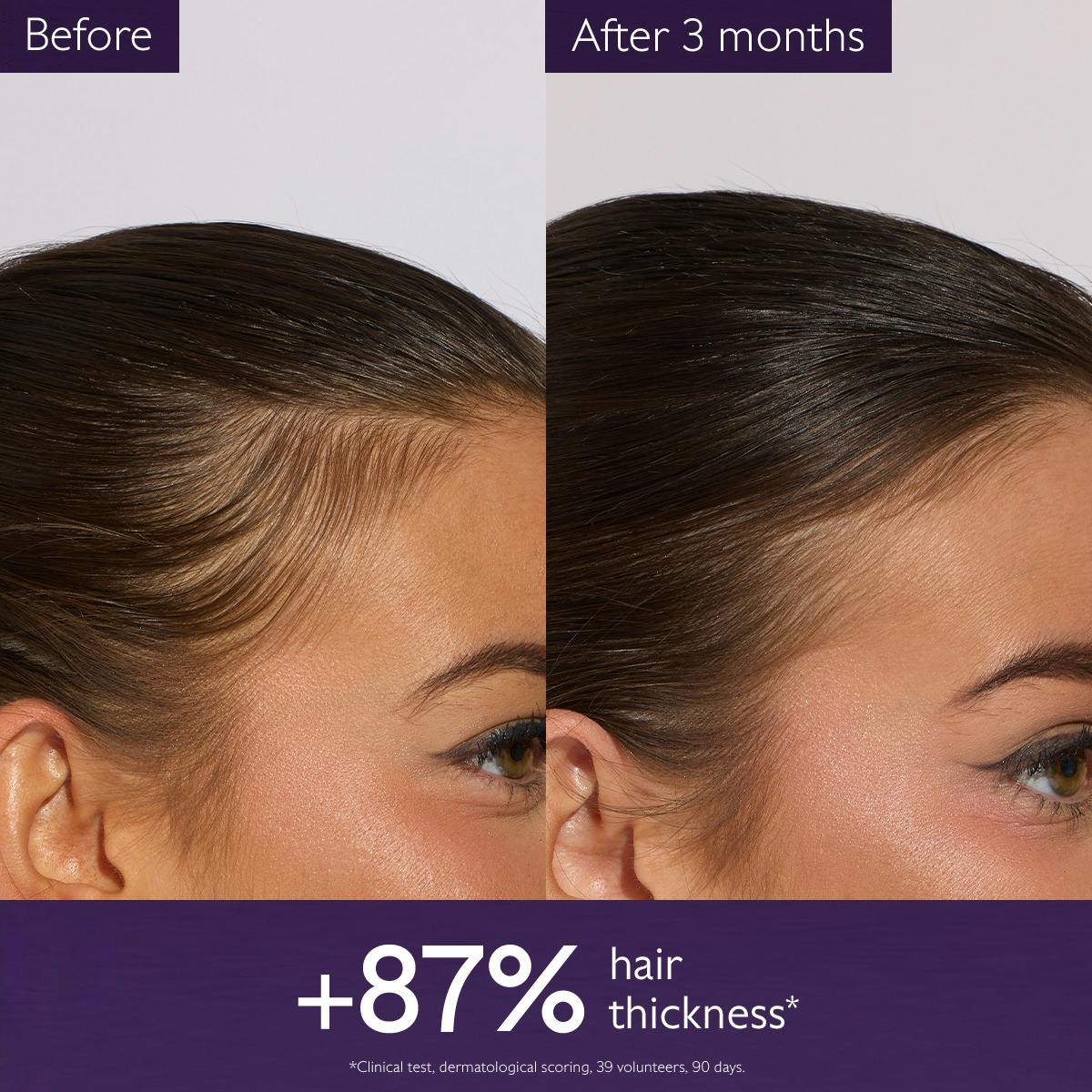 Anti-Hair Loss Serum