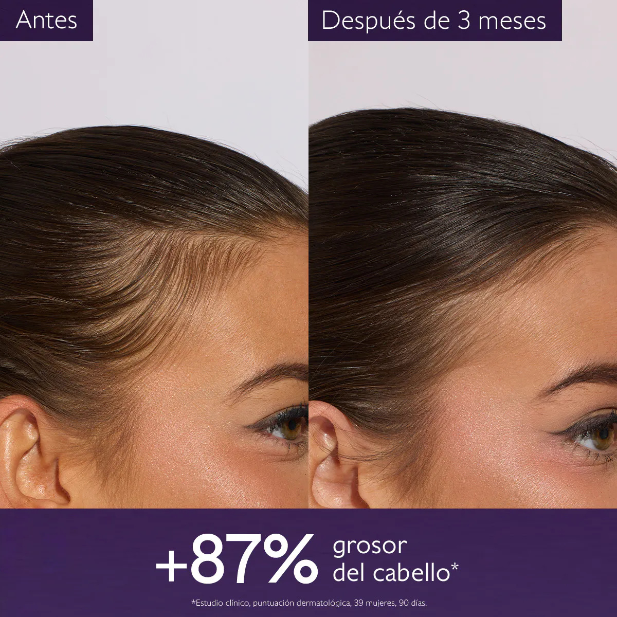 Sérum Capilar Anticaída