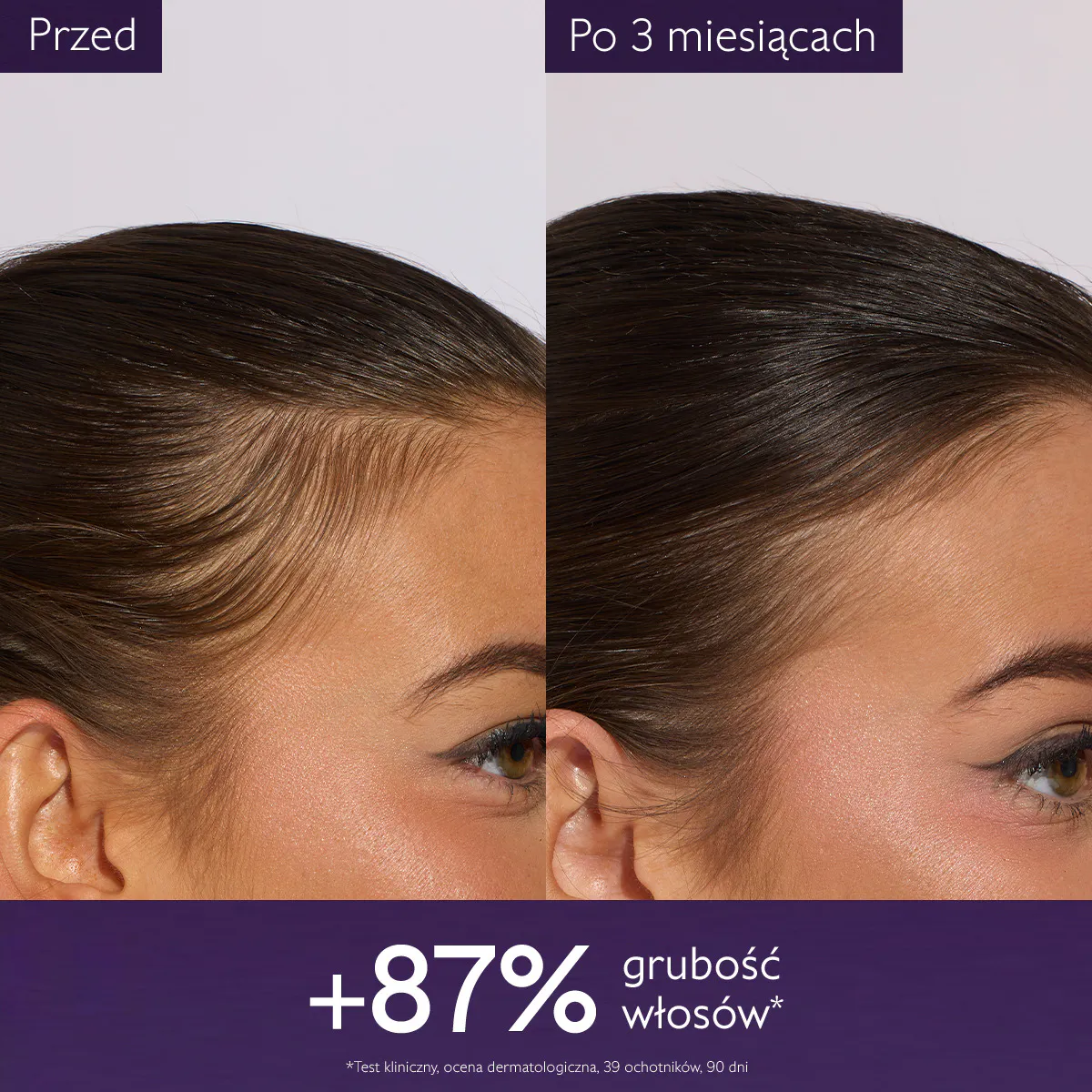 Serum przeciw wypadaniu włosów