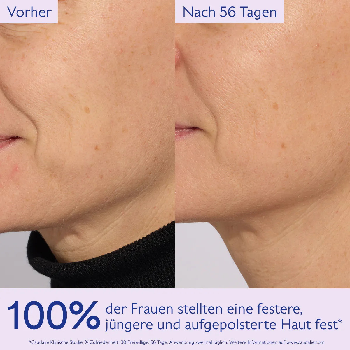 Lifting Straffungsserum / Nachfüllpackung