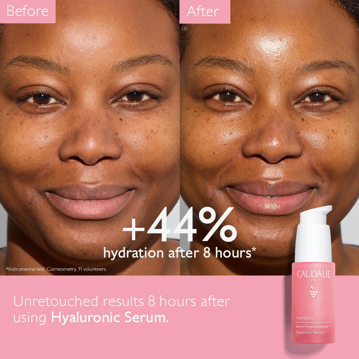 Hyaluronic  Acid Serum
