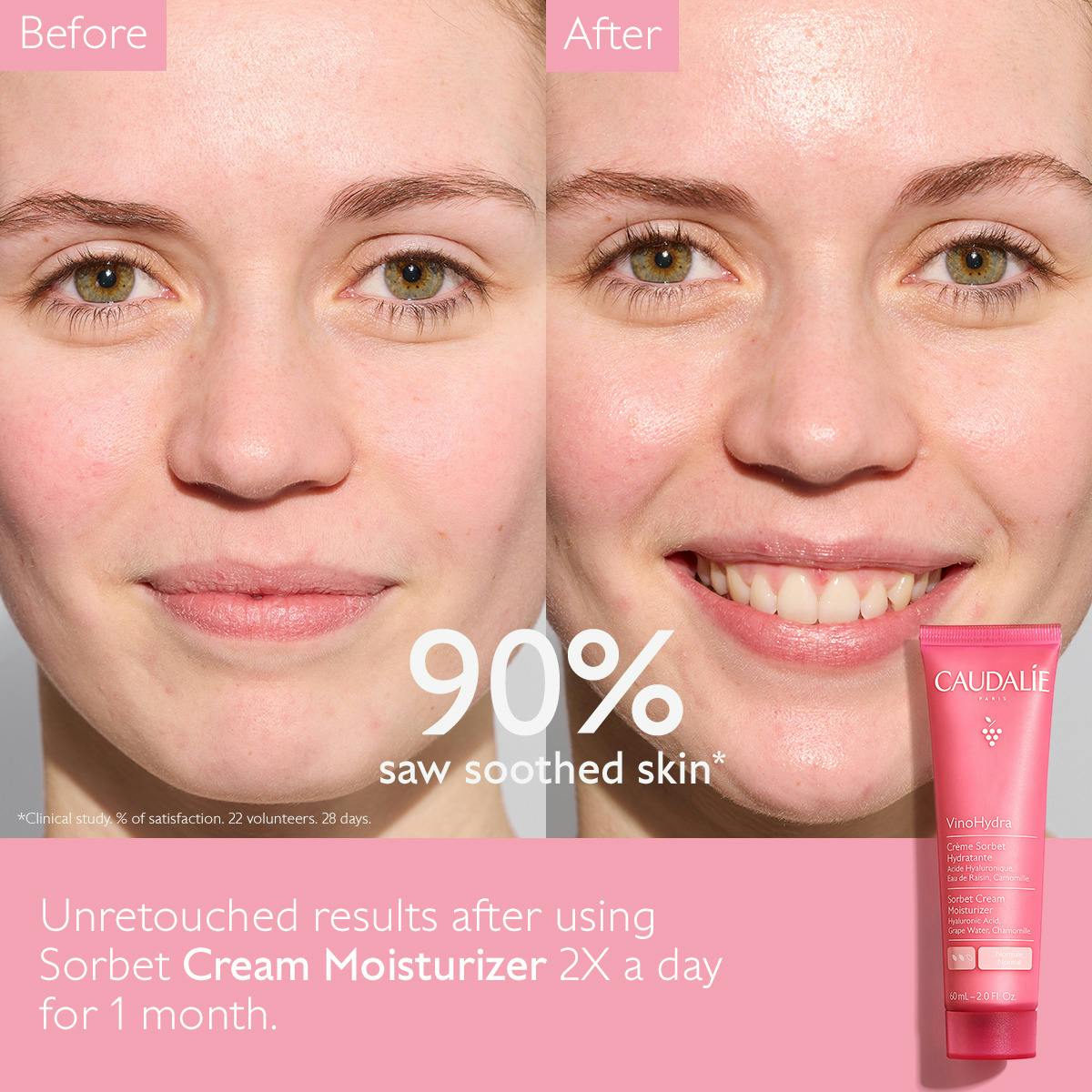Sorbet Cream Moisturiser with Hyaluronic Acid