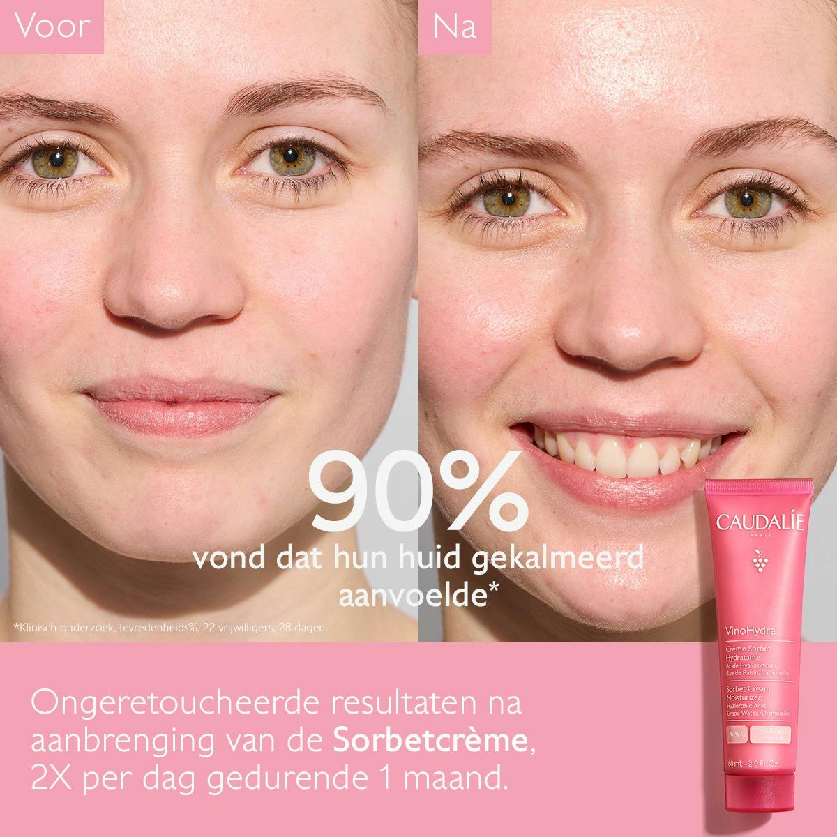 Hydraterende Sorbetcrème