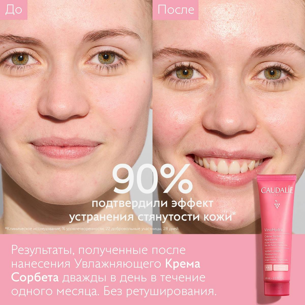 Увлажняющий Kрем Сорбет