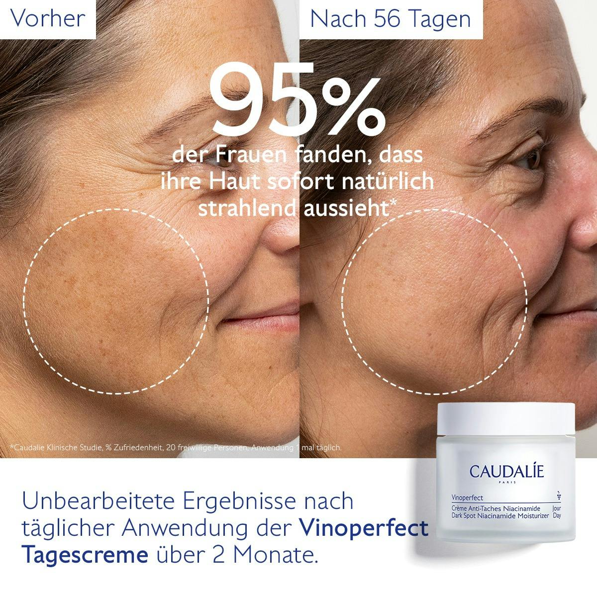 Anti-Pigmentflecken Creme mit Niacinamid & Viniferine
