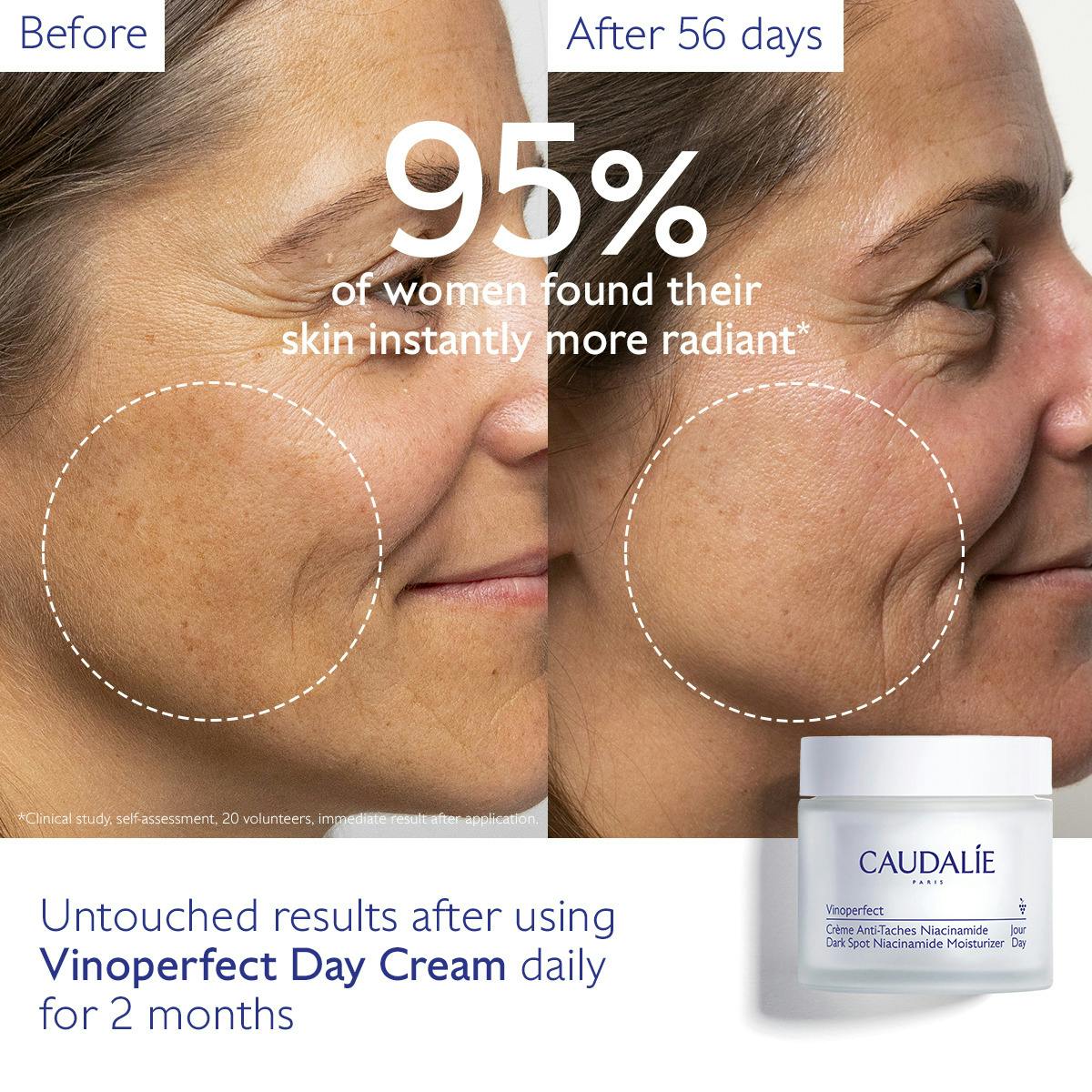 Dark Spot Niacinamide Moisturizer