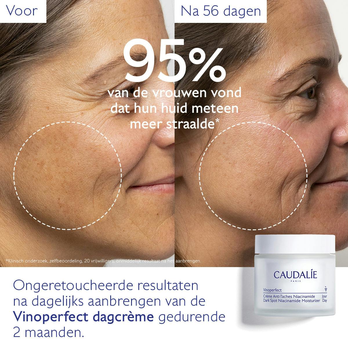 Crème met Niacinamide tegen Pigmentvlekken