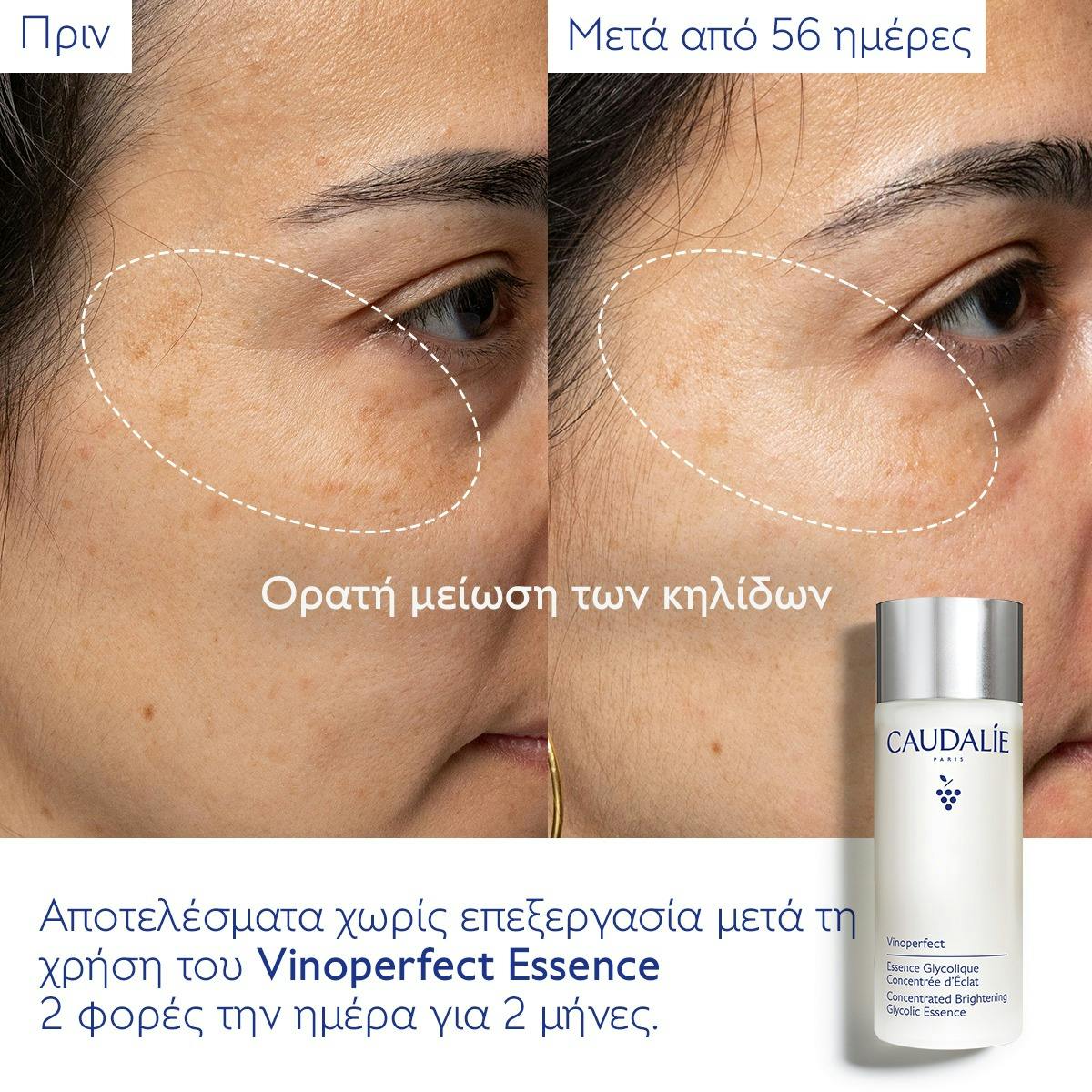 Essence Glycolique Concentrée d'Éclat