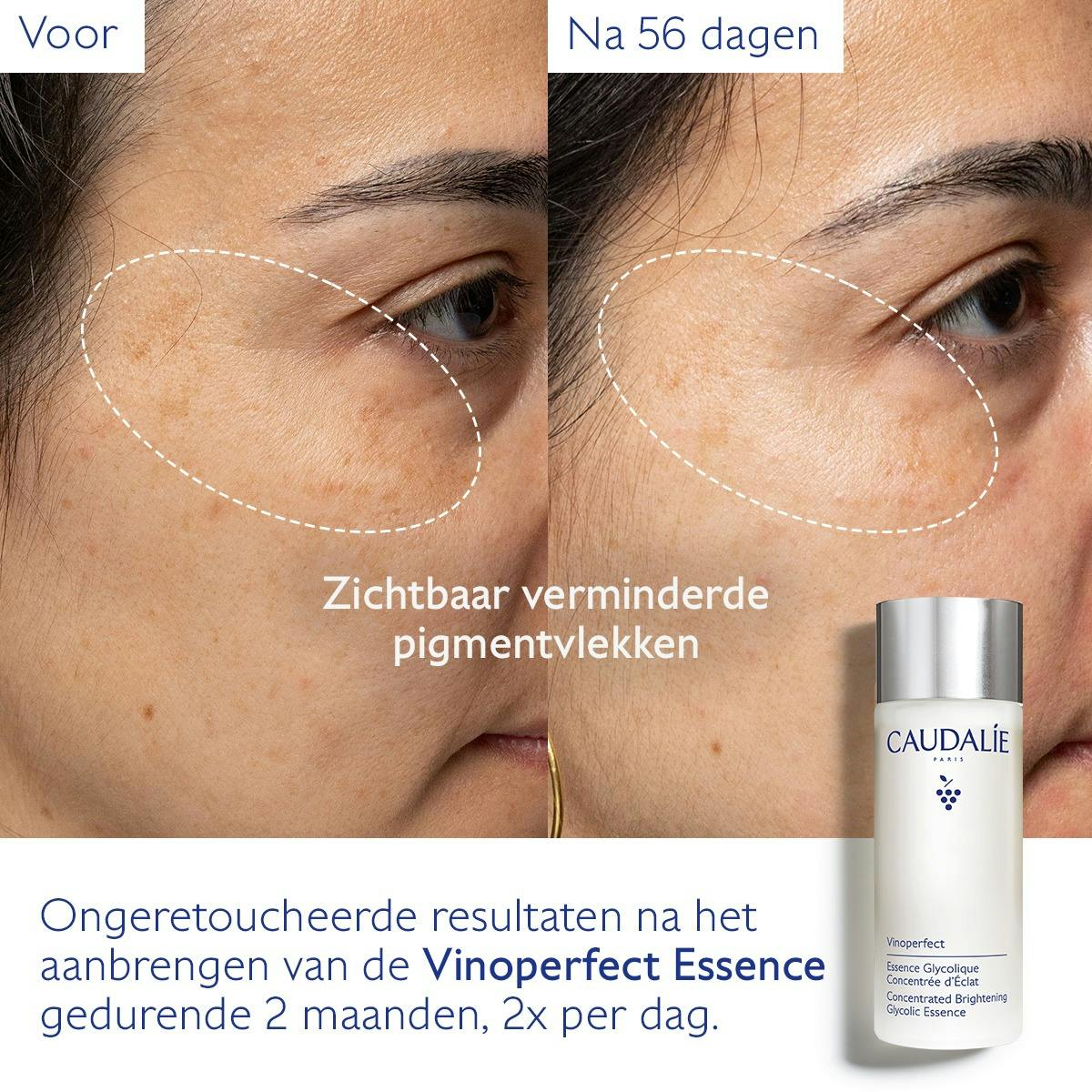 Geconcentreerde Éclat Glycolic Essence