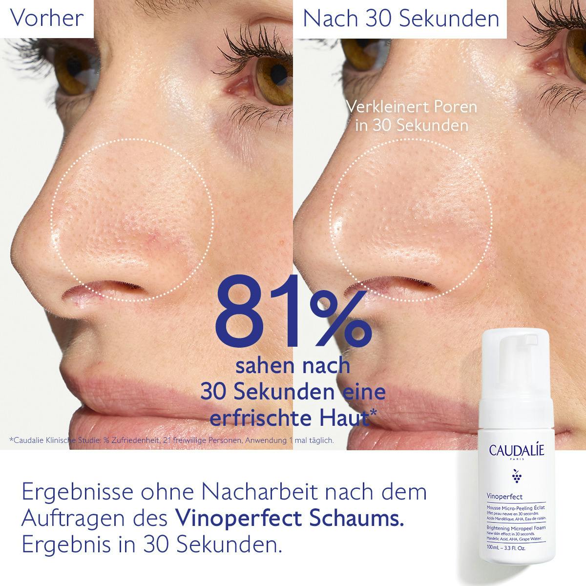 Mikro-Peeling Schaum Ausstrahlung mit Mandelsäure (AHA)