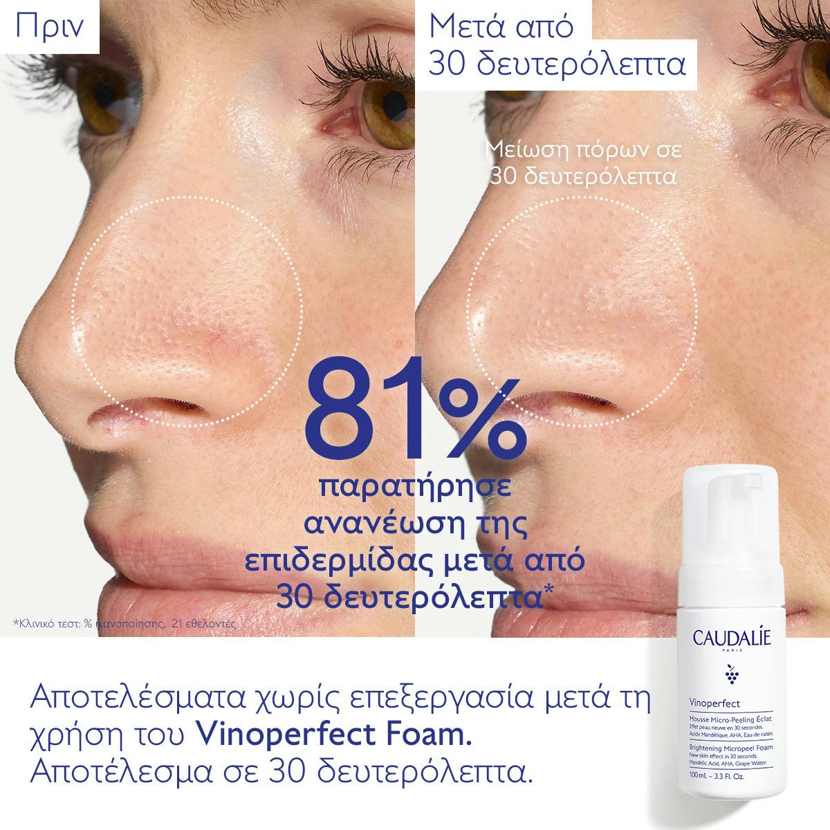Brightening Micropeel Foam Vinoperfect