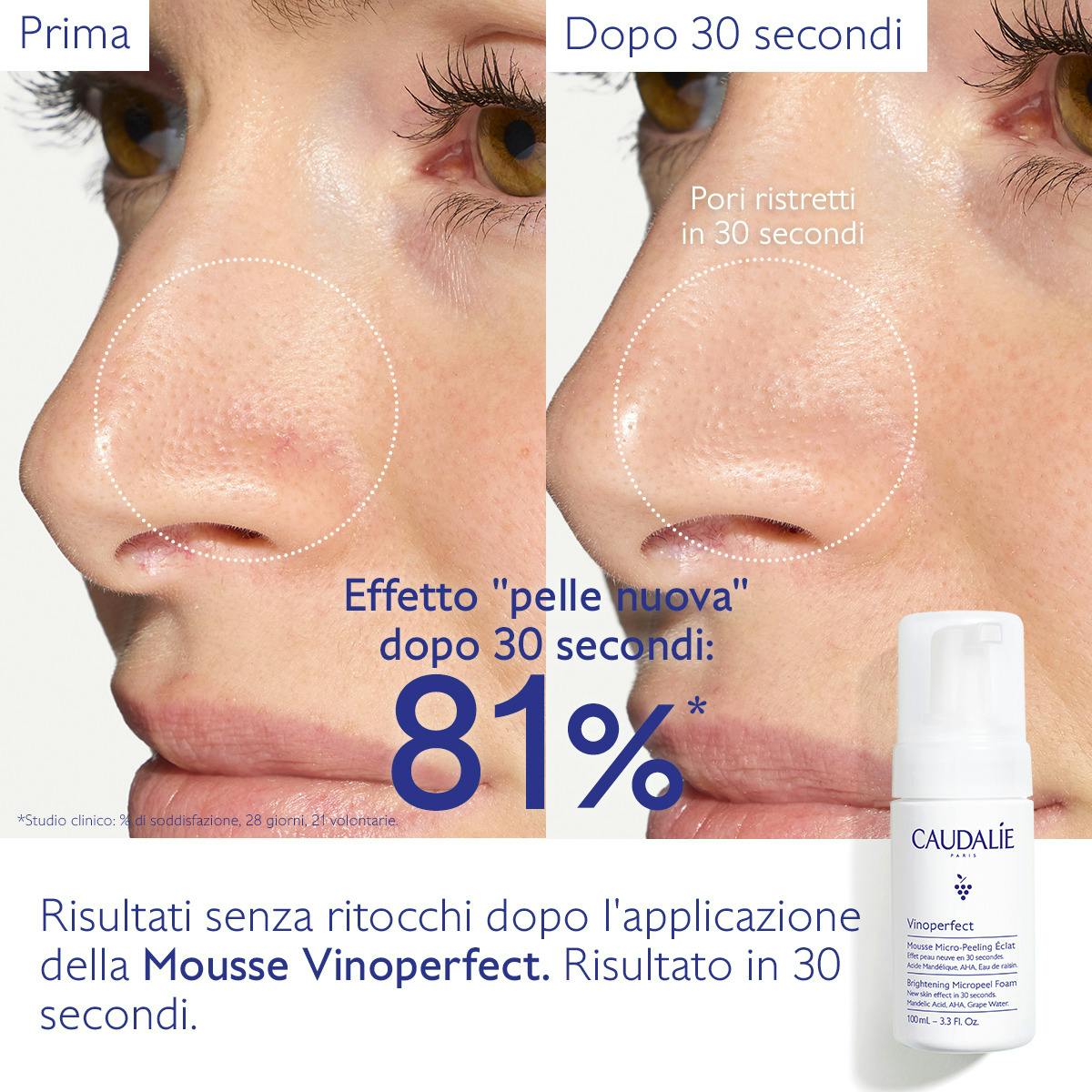 Mousse Micro-Peeling Illuminante con Acido Mandelico (AHA)