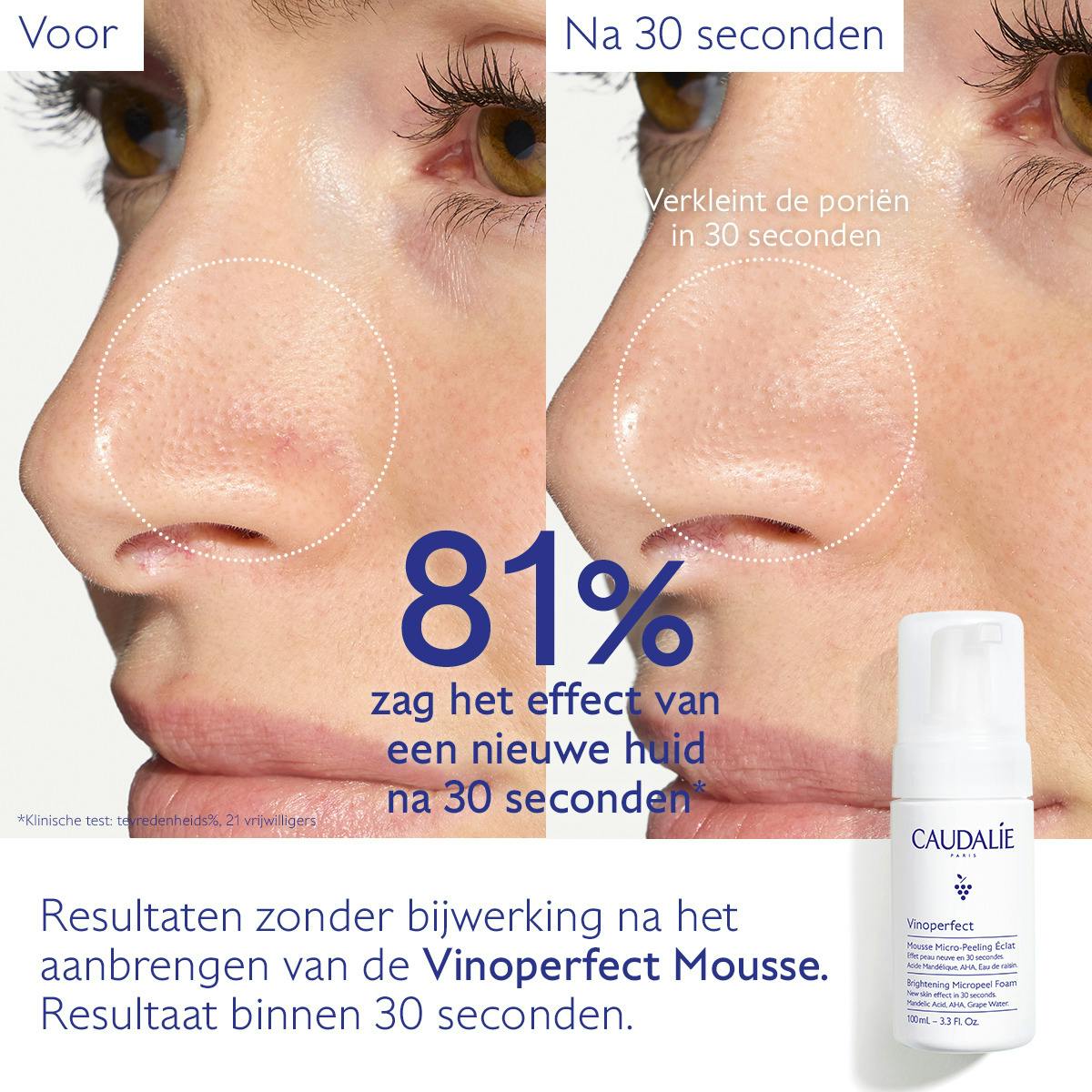 Micro-Peeling Mousse Stralende Huid