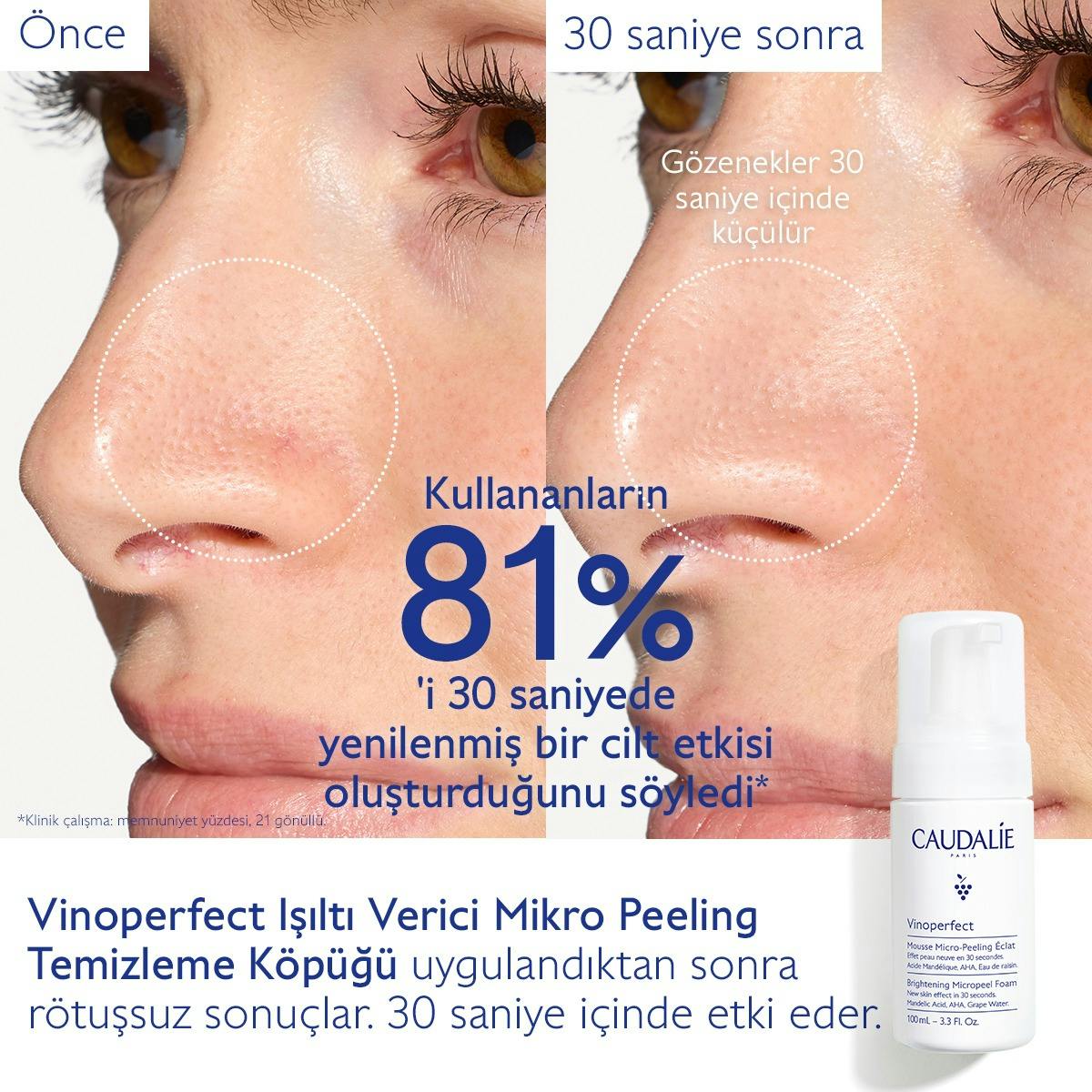 Vinoperfect Işıltı Verici Mikro Peeling Temizleme Köpüğü