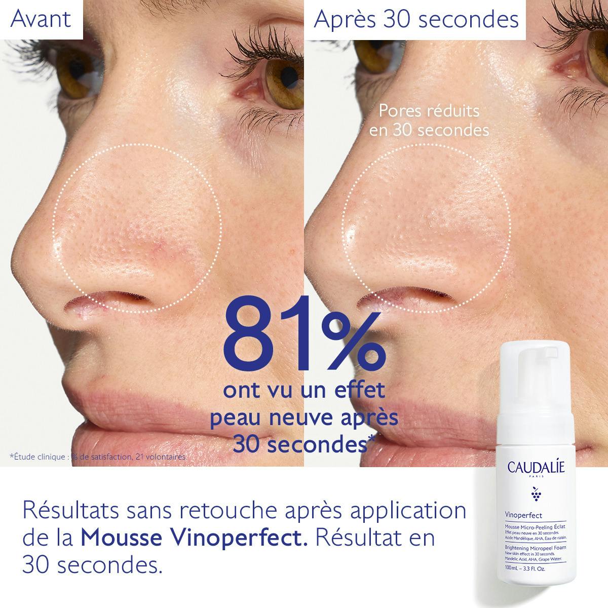 Mousse Micro-Peeling Éclat à l'Acide Mandélique (AHA)