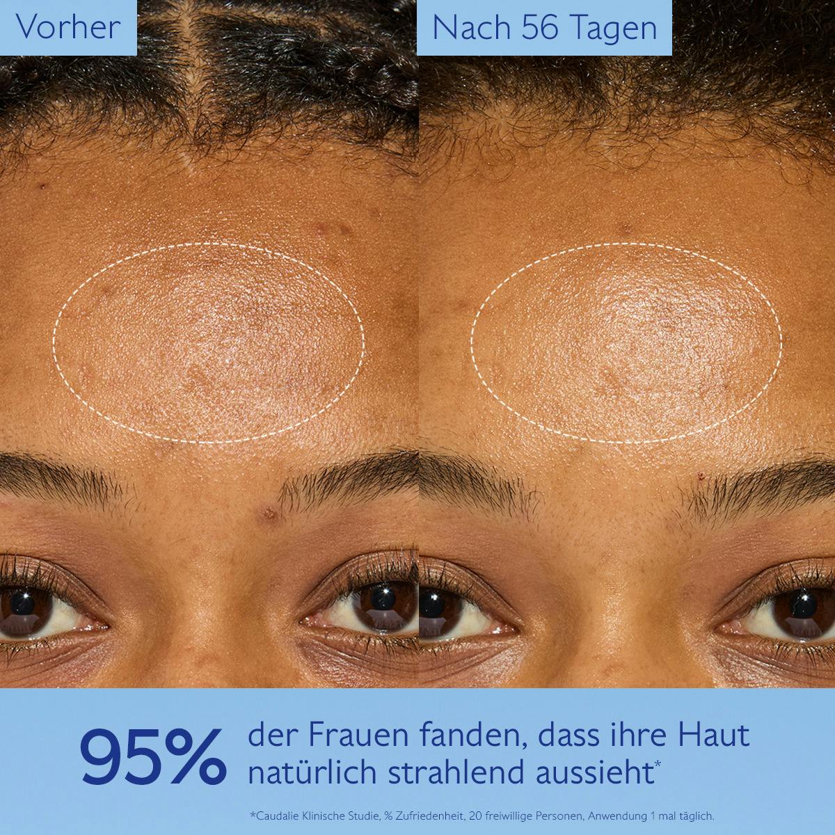 Anti-Pigmentflecken Creme mit Niacinamid & Viniferine