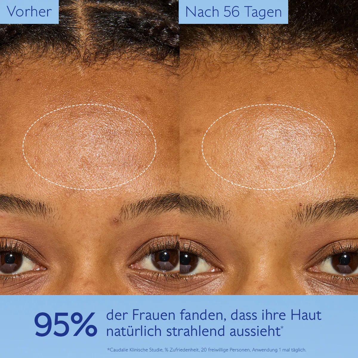 Anti-Pigmentflecken Creme mit Niacinamid & Viniferine