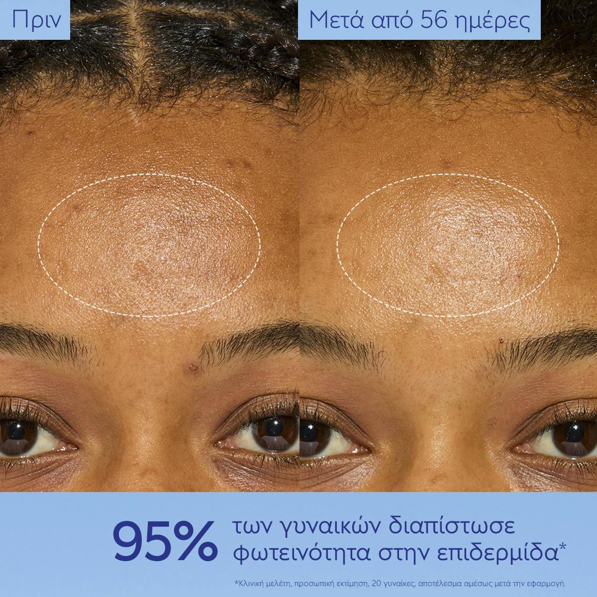 Dark Spot Niacinamide Moisturizer