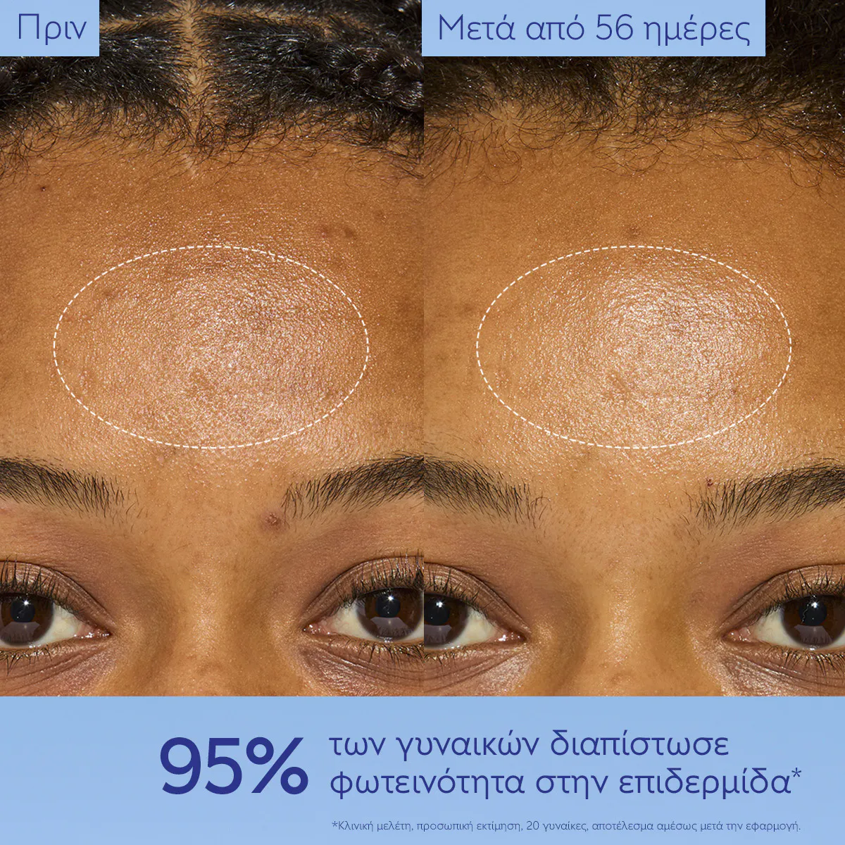 Dark Spot Niacinamide Moisturizer