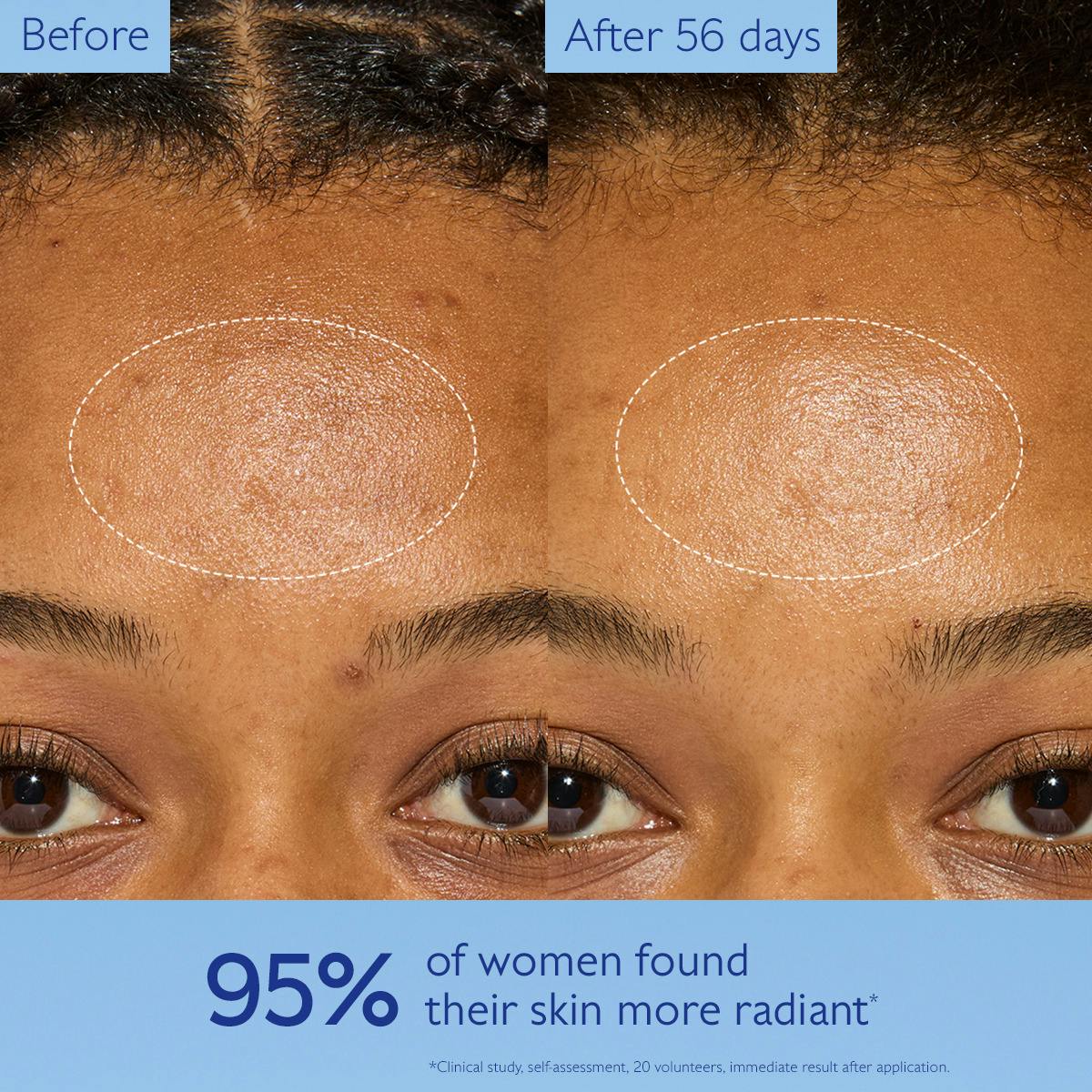 Dark Spot Niacinamide Moisturizer