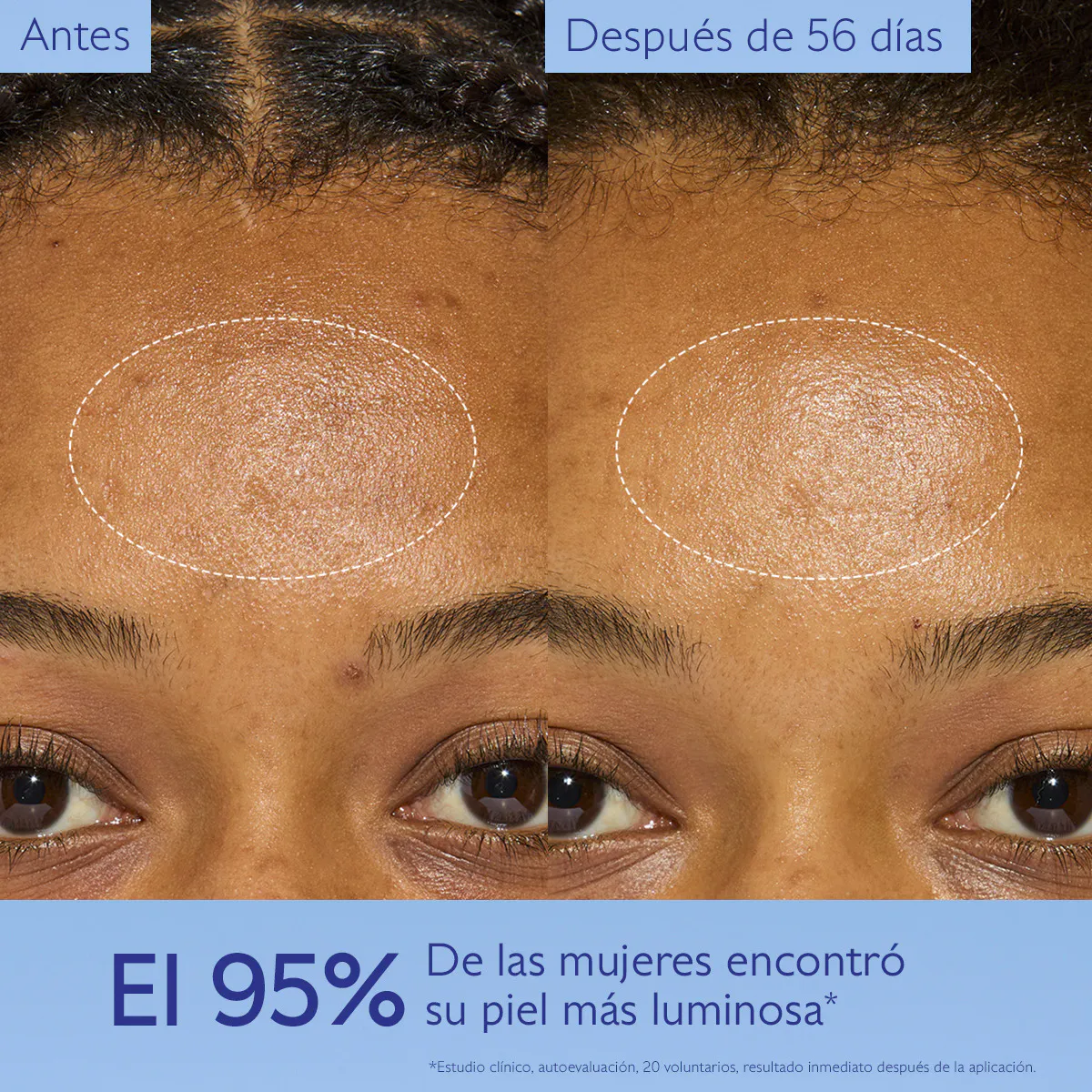 Crema Antimanchas Niacinamida