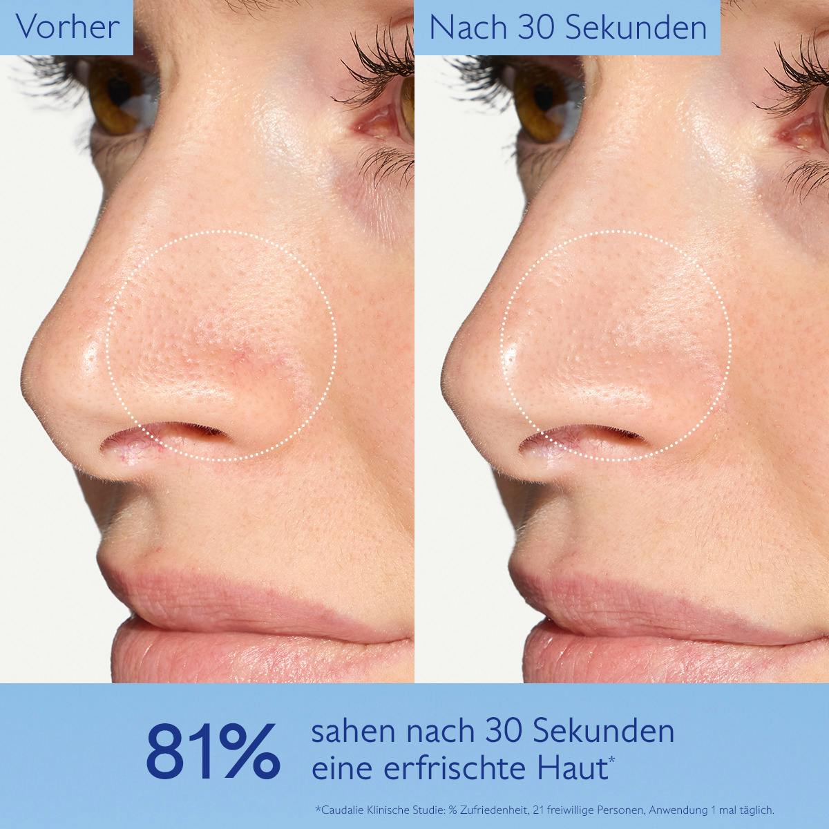 Mikro-Peeling Schaum Ausstrahlung mit Mandelsäure (AHA)