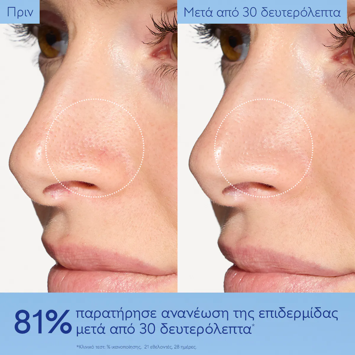 Brightening Micropeel Foam Vinoperfect