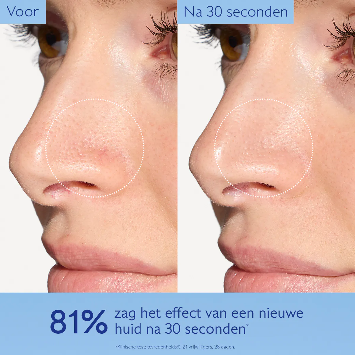 Micro-Peeling Mousse Stralende Huid