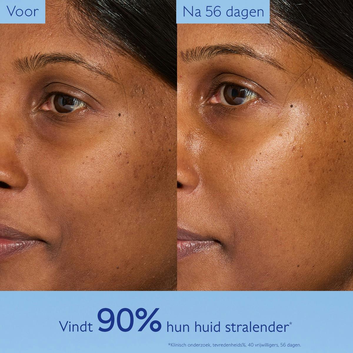 Glycol Nachtcrème tegen Pigmentvlekken